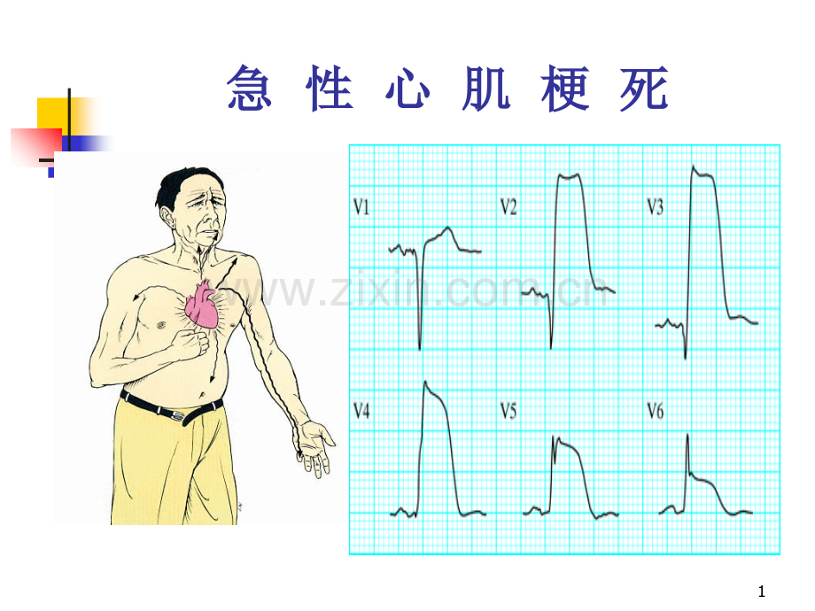 心电图诊断1--基础和正常.ppt_第1页