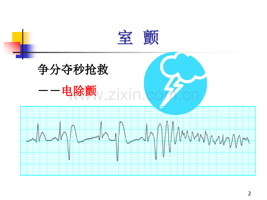 心电图诊断1--基础和正常.ppt_第2页