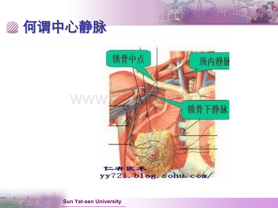 全面了解中心静脉置管及护理.ppt_第1页