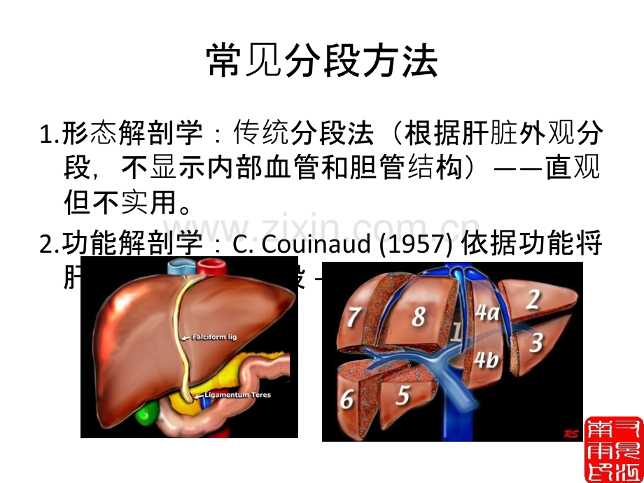 肝脏正常解剖和检查方法.ppt_第2页