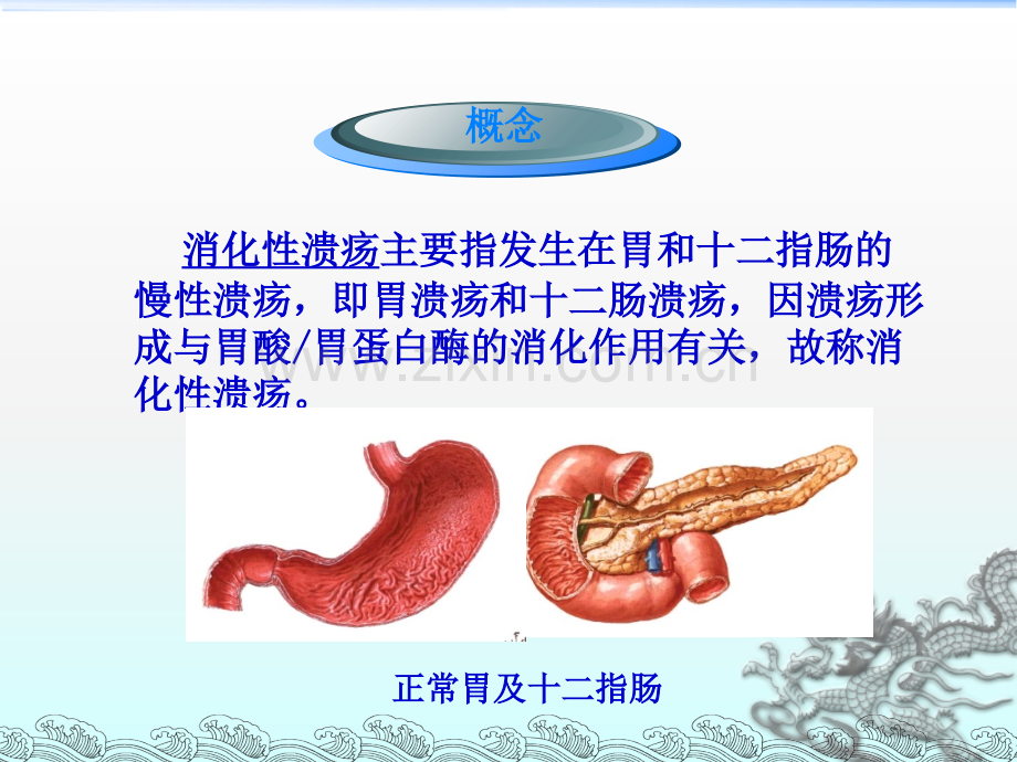 医学课件消化性溃疡的护理.ppt_第1页