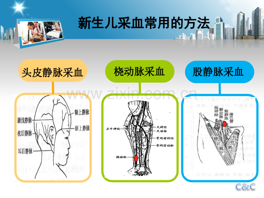 医学课件新生儿股静脉采血.ppt_第2页