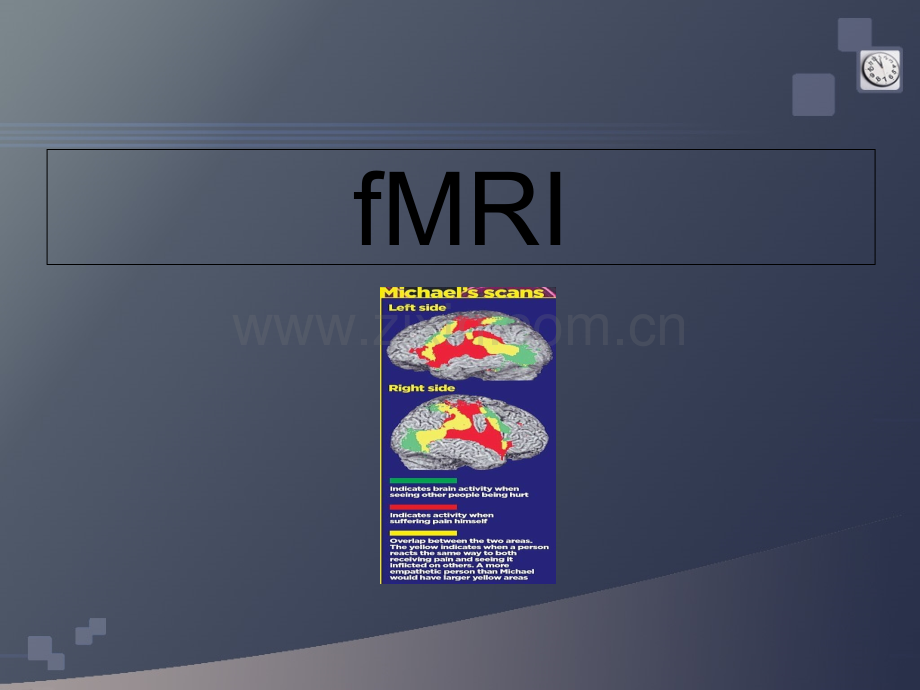 MRI和DTI的原理和应用简介课件.ppt_第3页