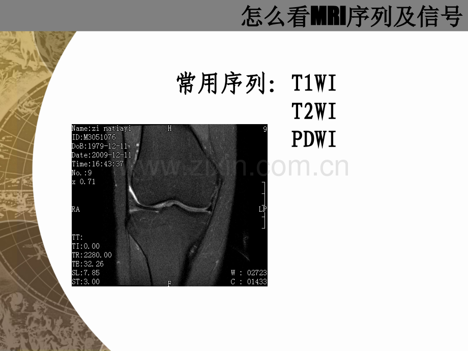 MRI相关医学知识课件.ppt_第2页