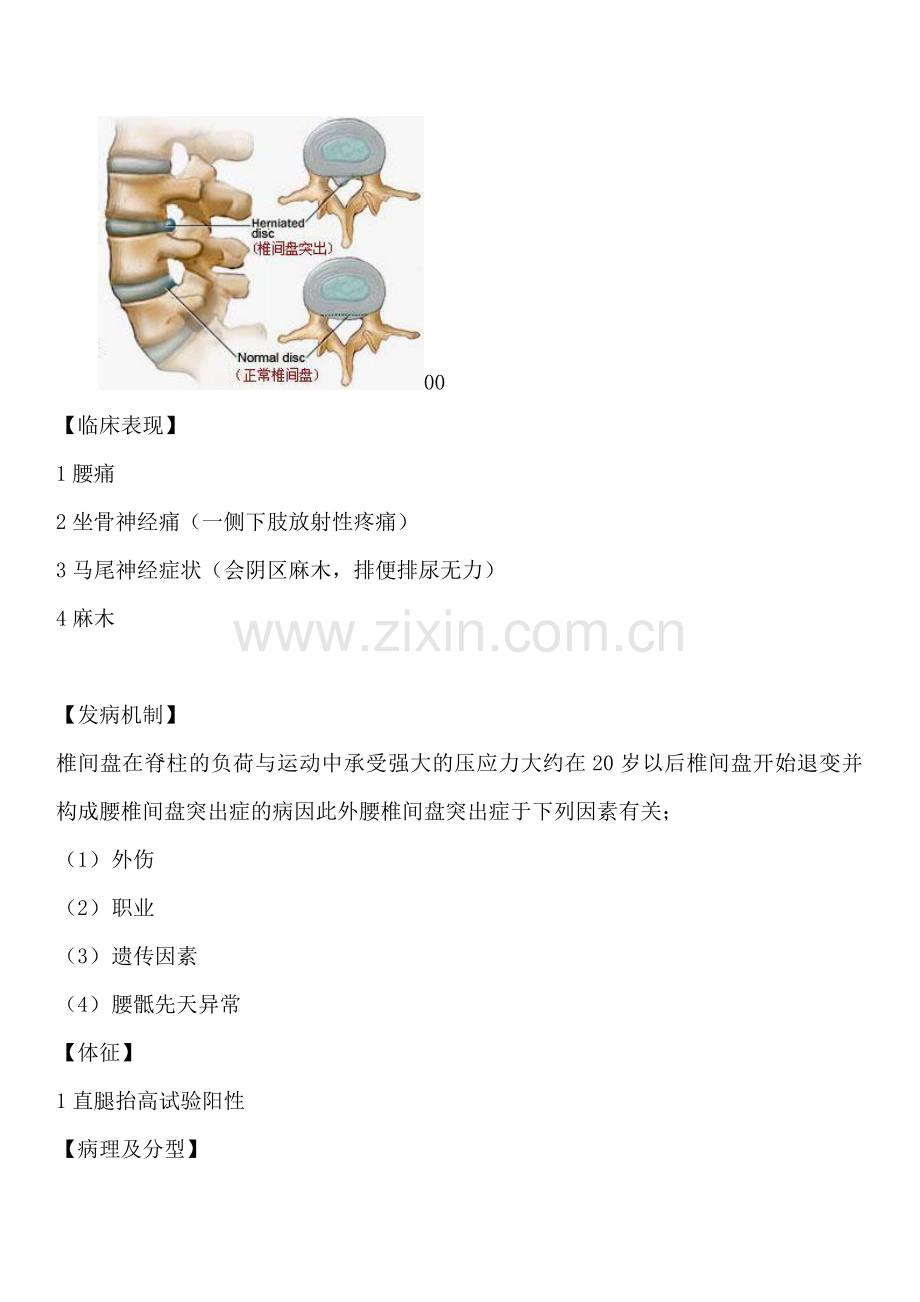 腰椎间盘突出症的护理查房资料.doc_第3页