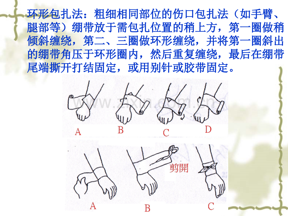 医学简单实用急救和包扎技术ppt.ppt_第3页