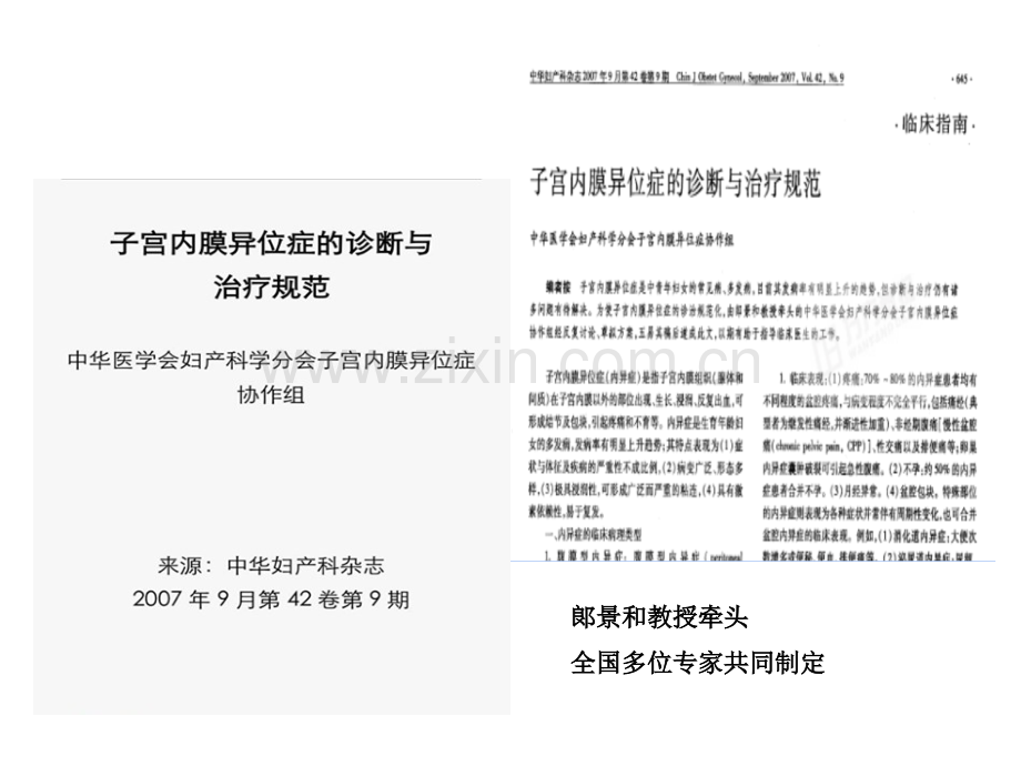 医学子宫内膜异位症诊治指南PPT.ppt_第2页