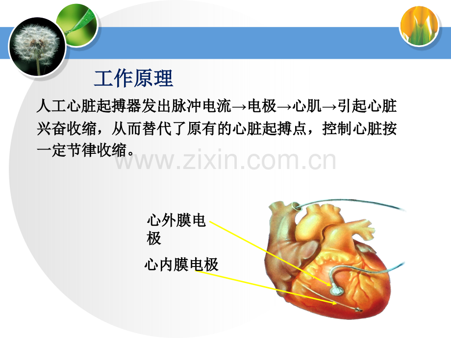 心脏外科留置心外膜起搏器护理-.ppt_第3页