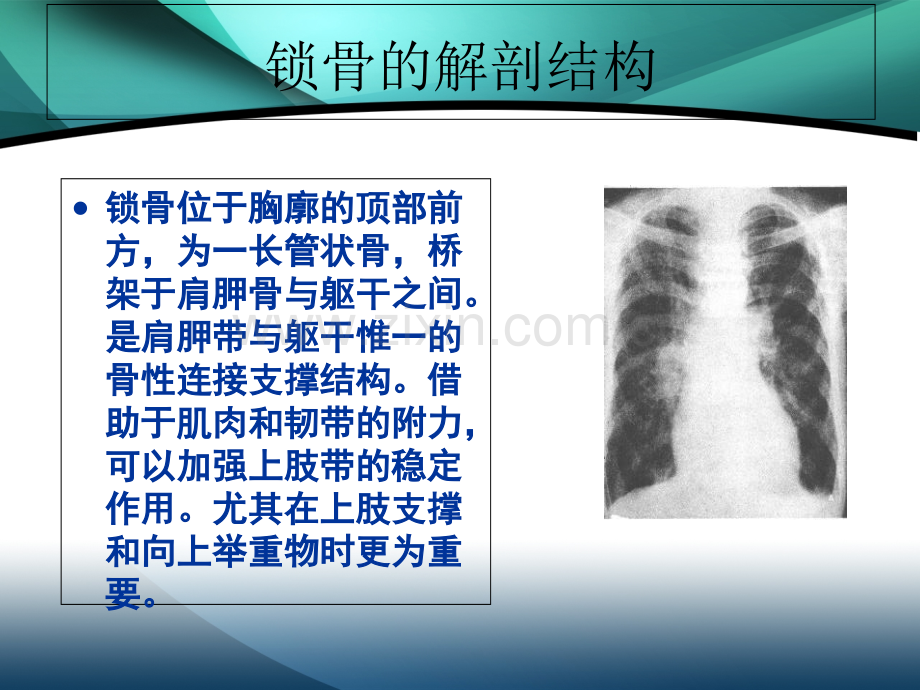 医学课件锁骨骨折的医疗护理主题讲座.ppt_第1页