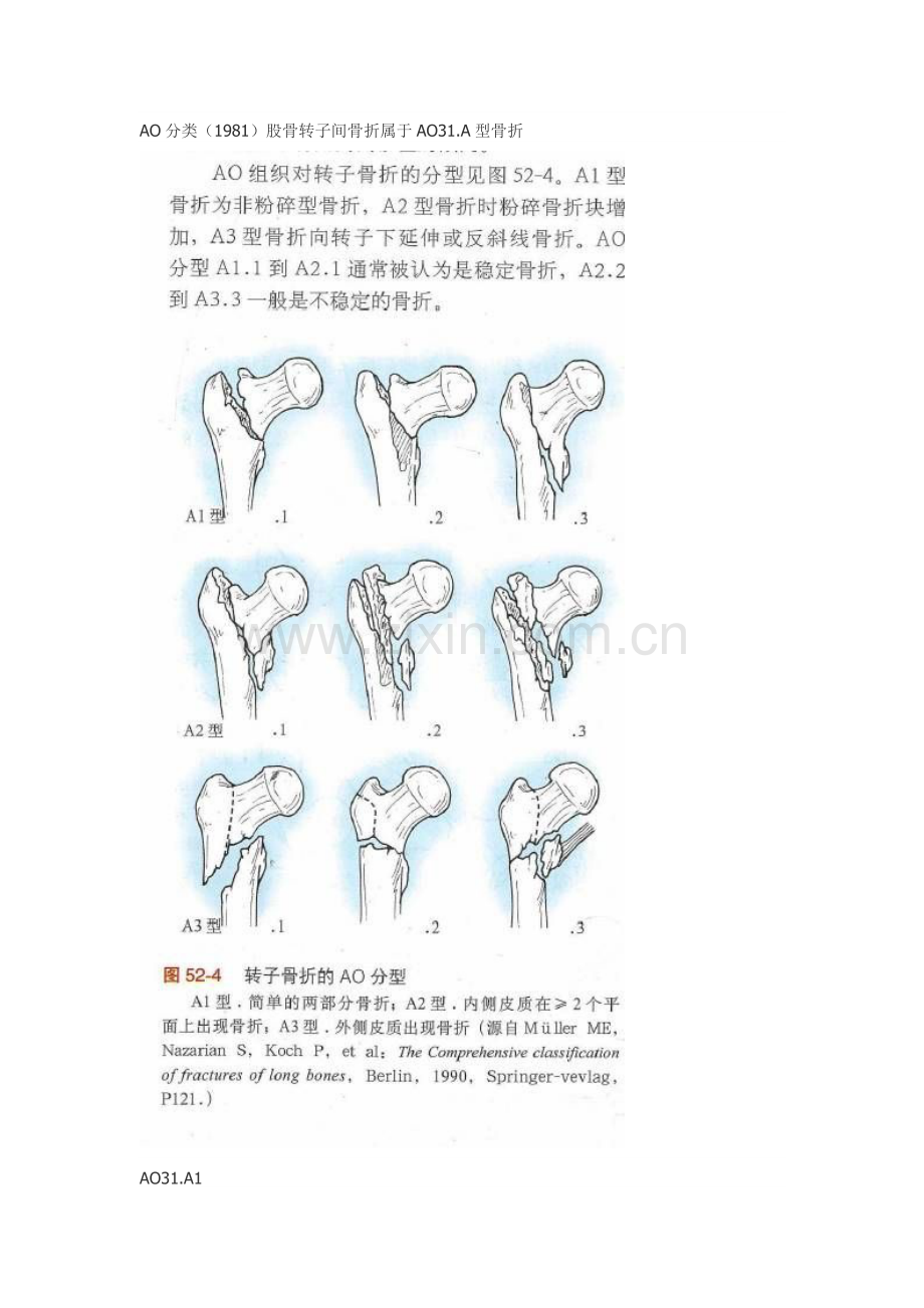 股骨转子间骨折诊疗常规.doc_第3页