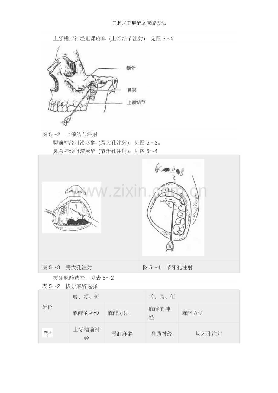 口腔局部麻醉之麻醉方法.doc_第3页