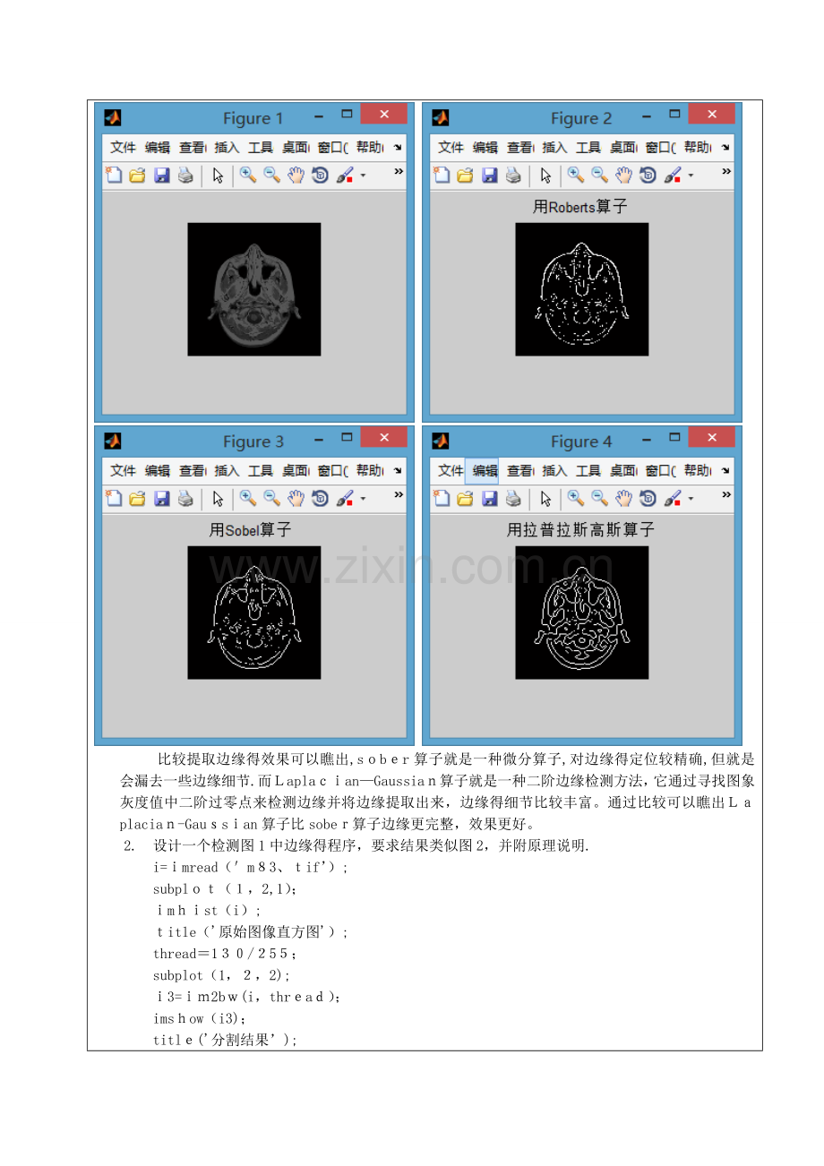 数字图像处理实验报告——图像分割实验.doc_第3页