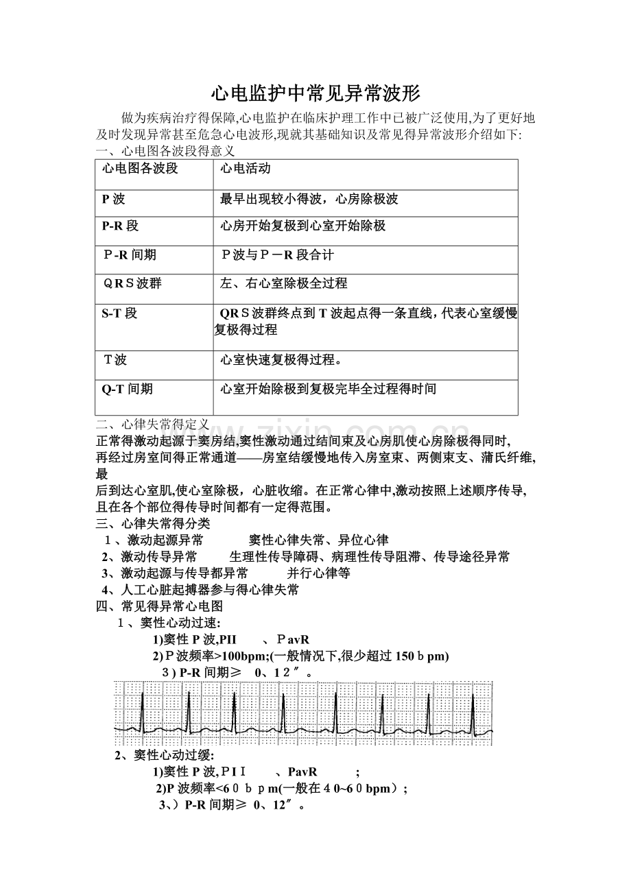 心电监护中常见的异常波形.doc_第1页