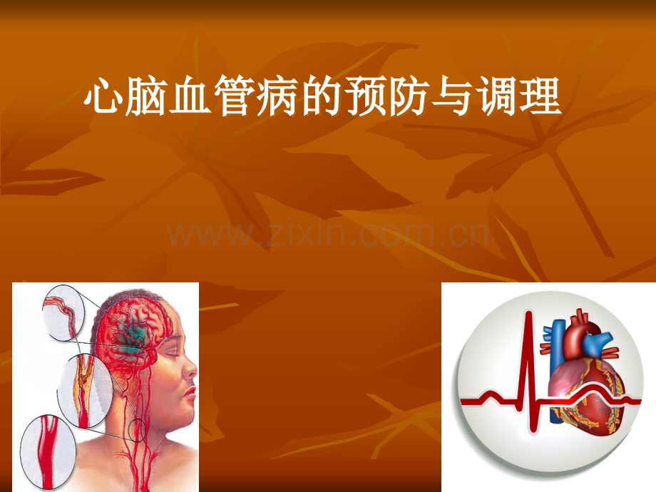 心脑血管疾病的预防与调理.ppt_第1页