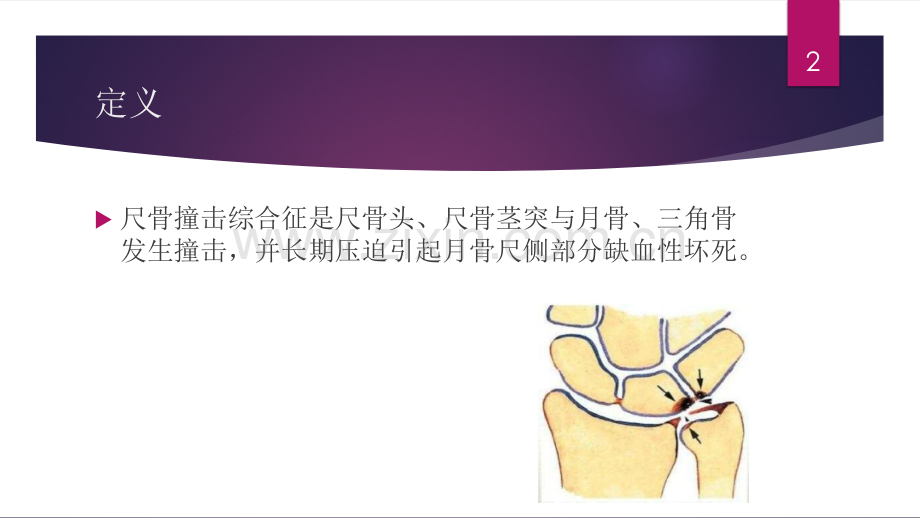 尺骨撞击综合征.ppt_第2页