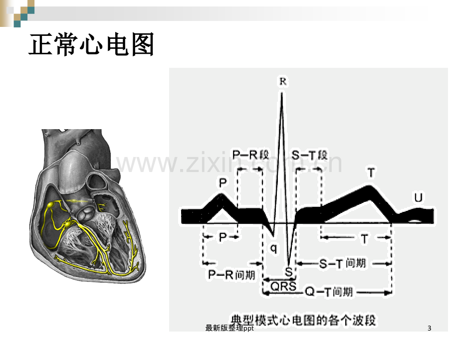 严重心律失常的急救与护理ppt课件.ppt_第3页