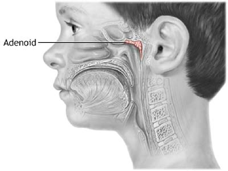 腺样体肥大医学PPT课件.ppt_第2页