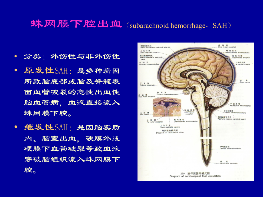 蛛网膜下腔出血演示文稿.ppt_第3页