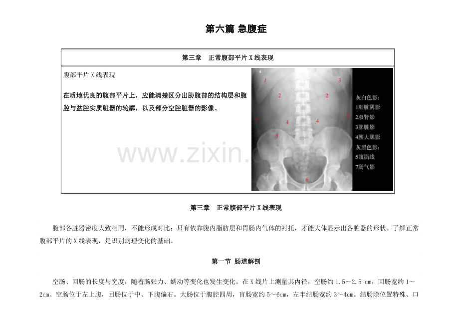 正常腹部平片X线表现.doc_第1页