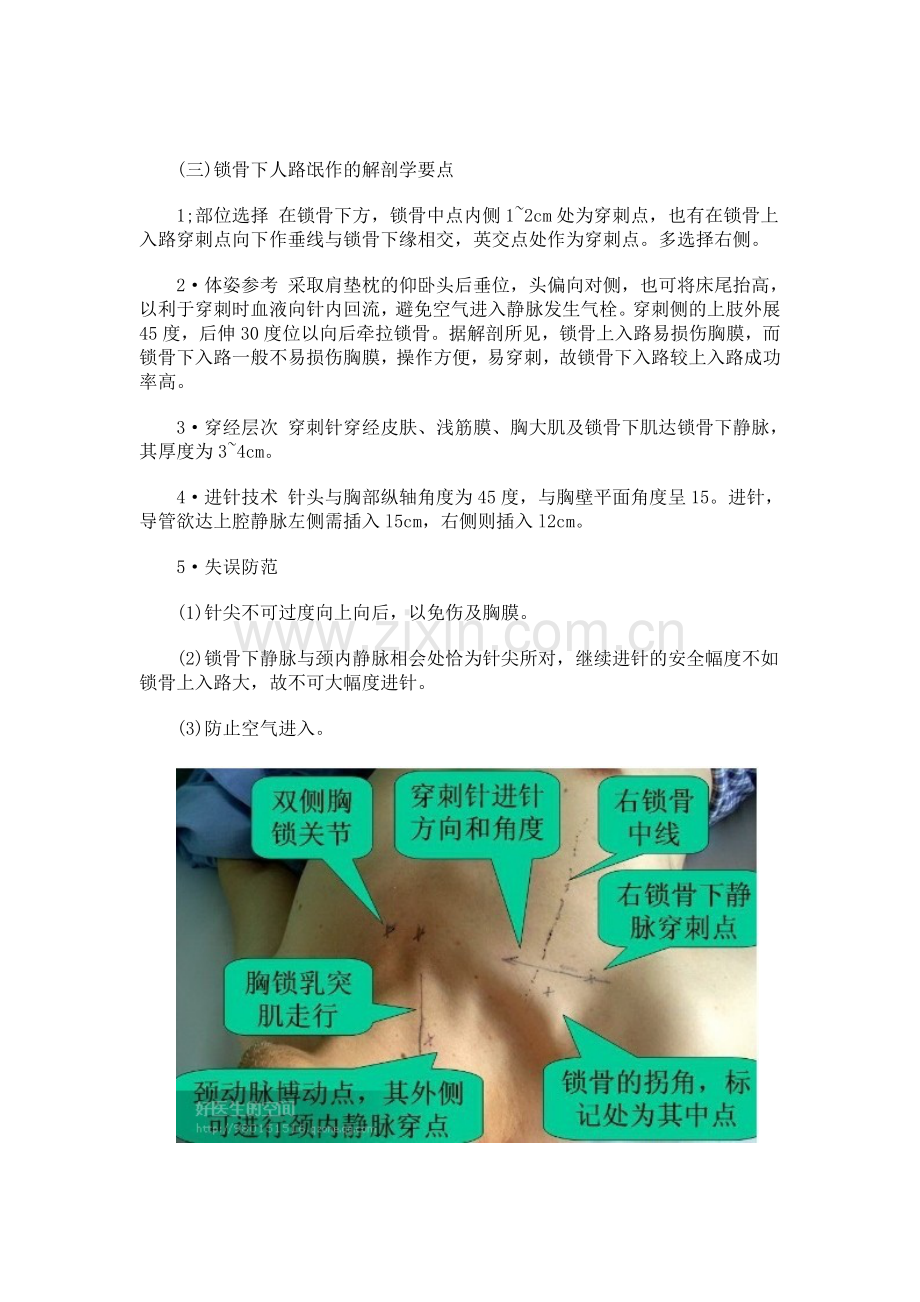 锁骨下静脉穿刺置管术应用解剖.doc_第2页