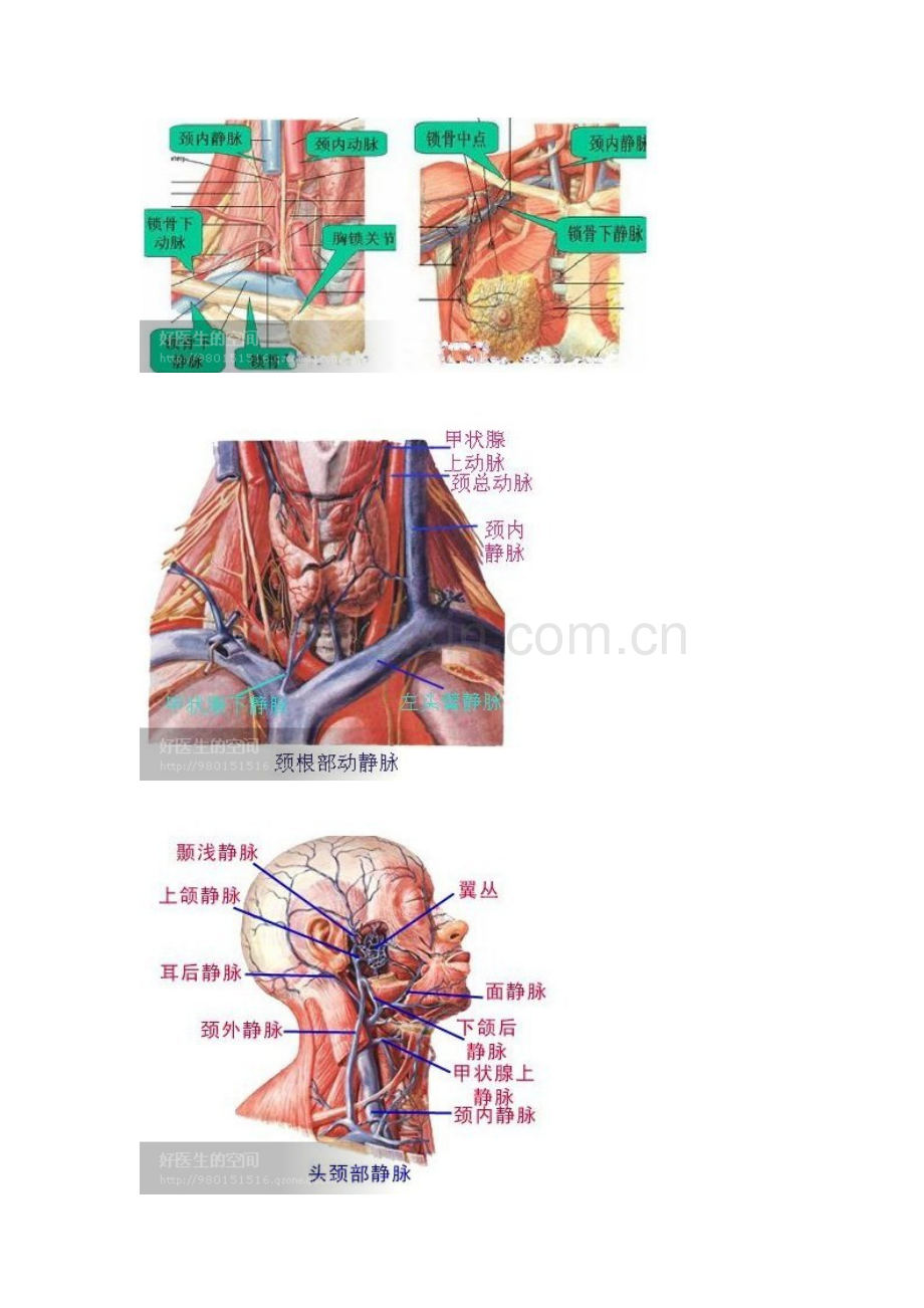 锁骨下静脉穿刺置管术应用解剖.doc_第3页