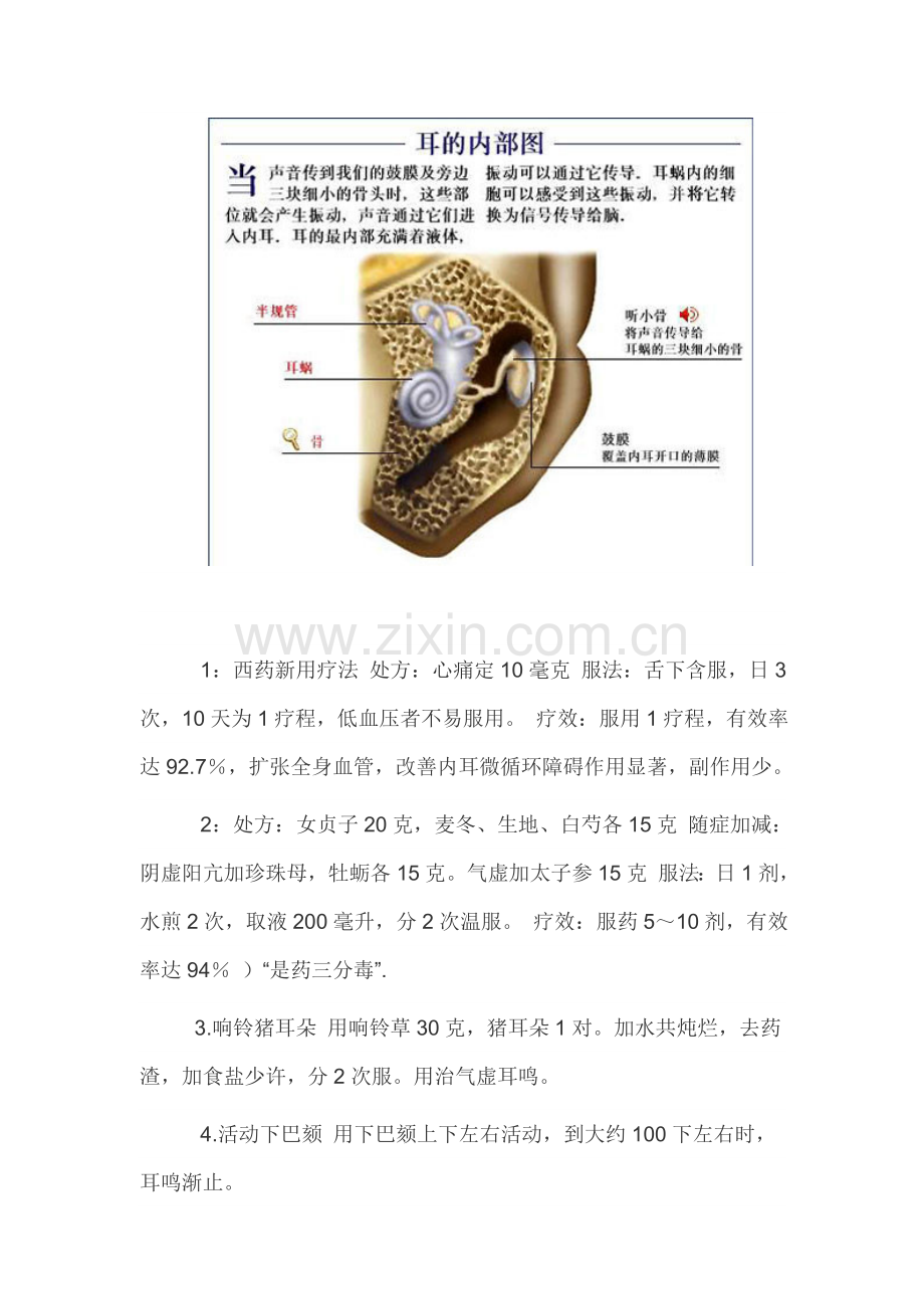 治疗耳鸣 根除结石的偏方.doc_第3页