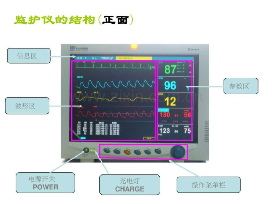 心电监护仪的使用-图文.ppt.pdf_第2页