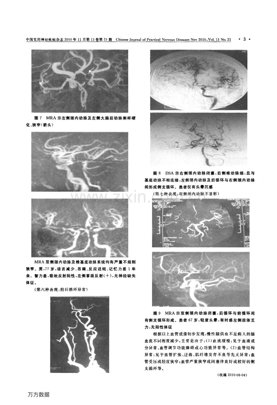 慢性脑供血不足的脑血流——与《中国后循环缺血专家共识》商榷.pdf_第3页