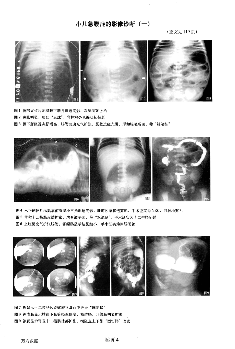 儿童腹部影像学诊断第2讲小儿急腹症的影像诊断(一).pdf_第3页