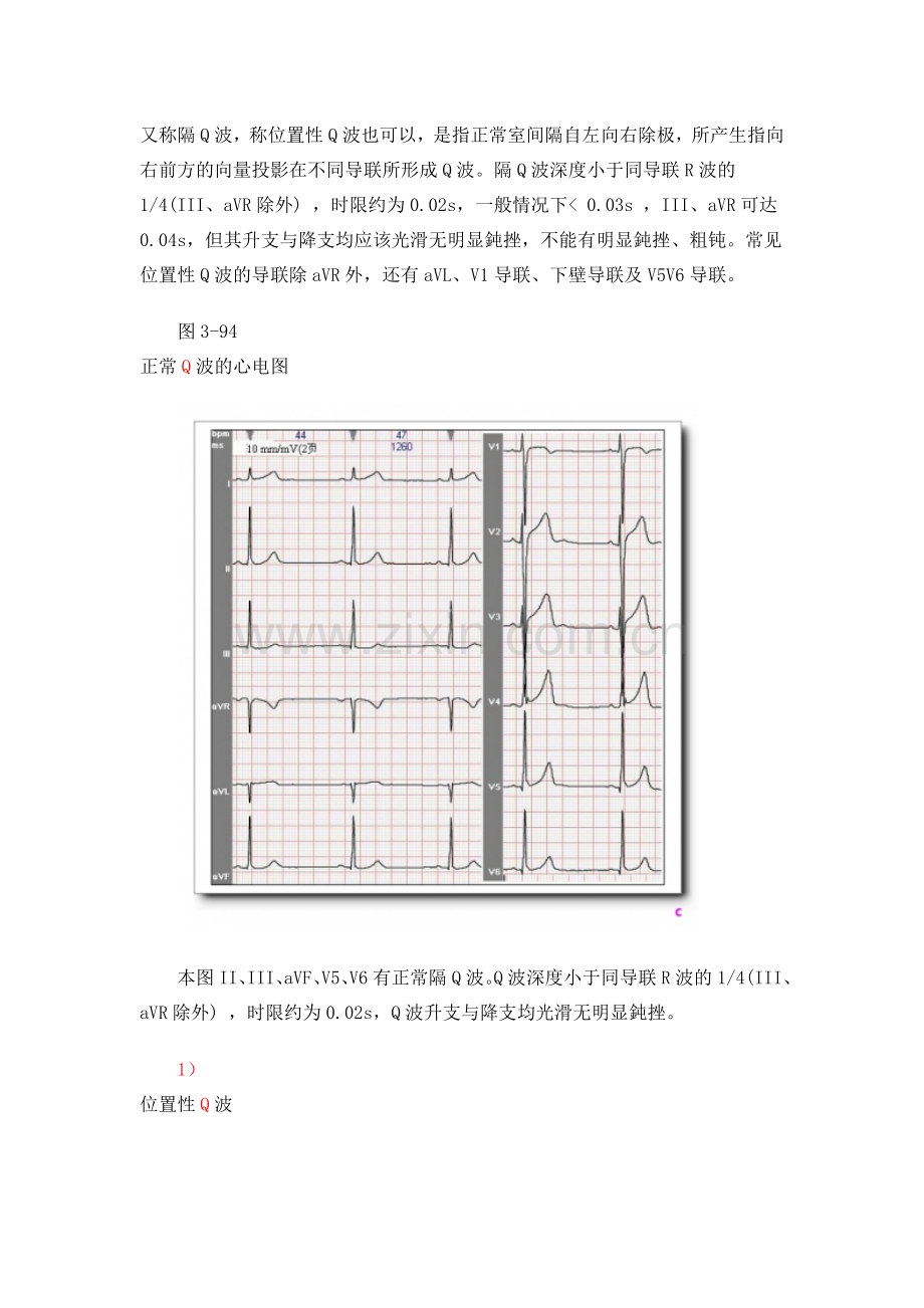 第九讲有关Q波知识.doc_第2页