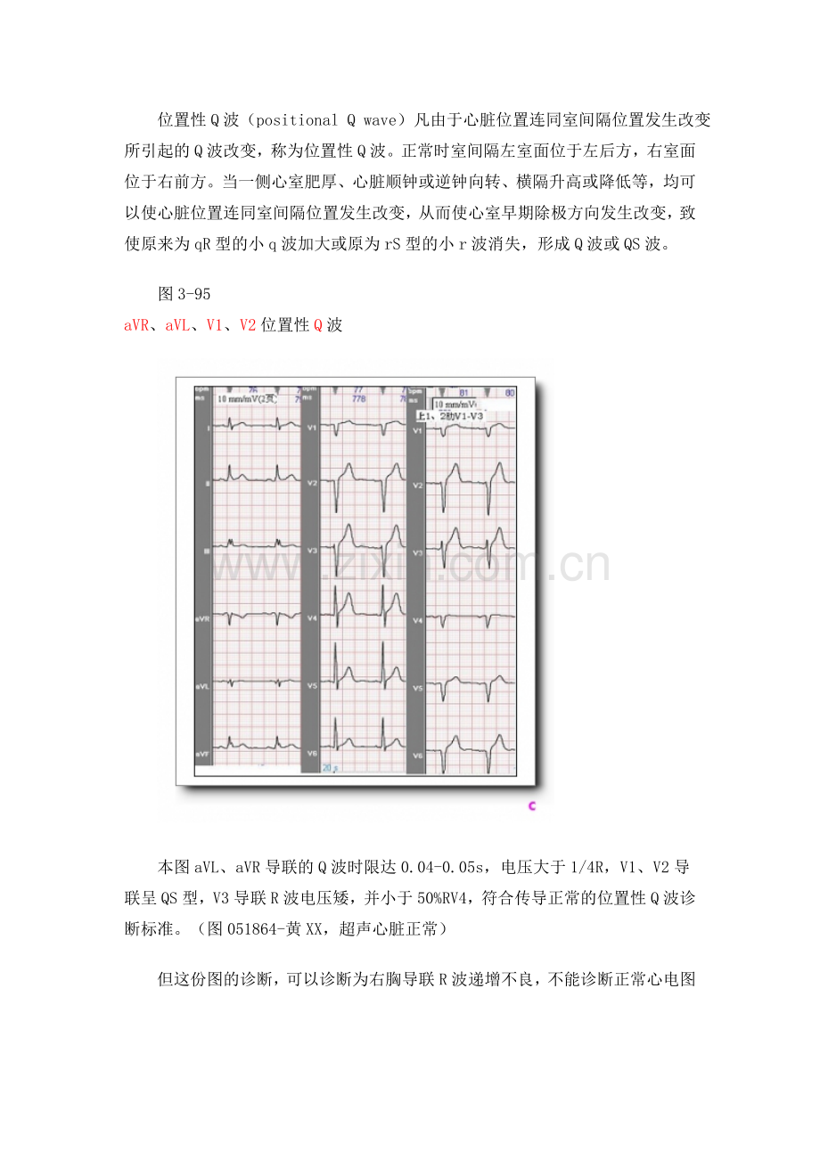 第九讲有关Q波知识.doc_第3页