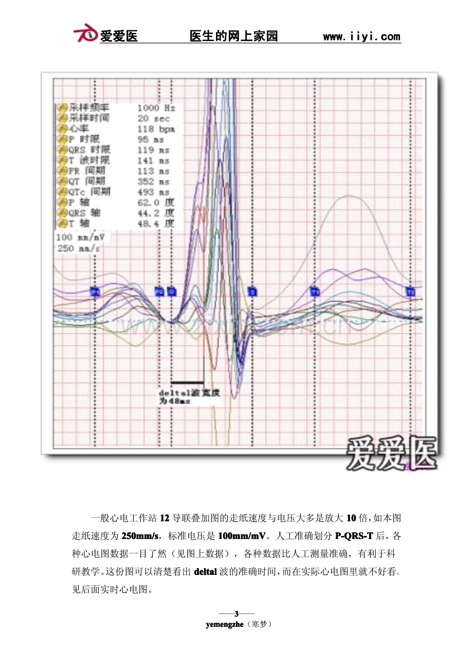 (十三)正常心电图、心律失常.pdf_第3页