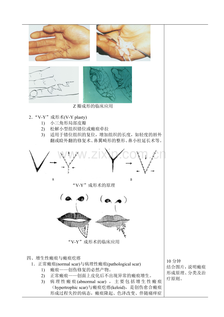 教案(整形外科学).doc_第3页