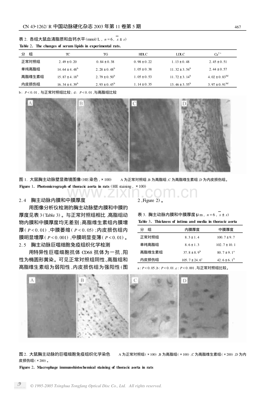 建立合适的动脉粥样硬化.pdf_第3页