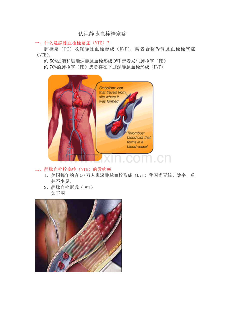 认识静脉血栓栓塞症.doc_第1页