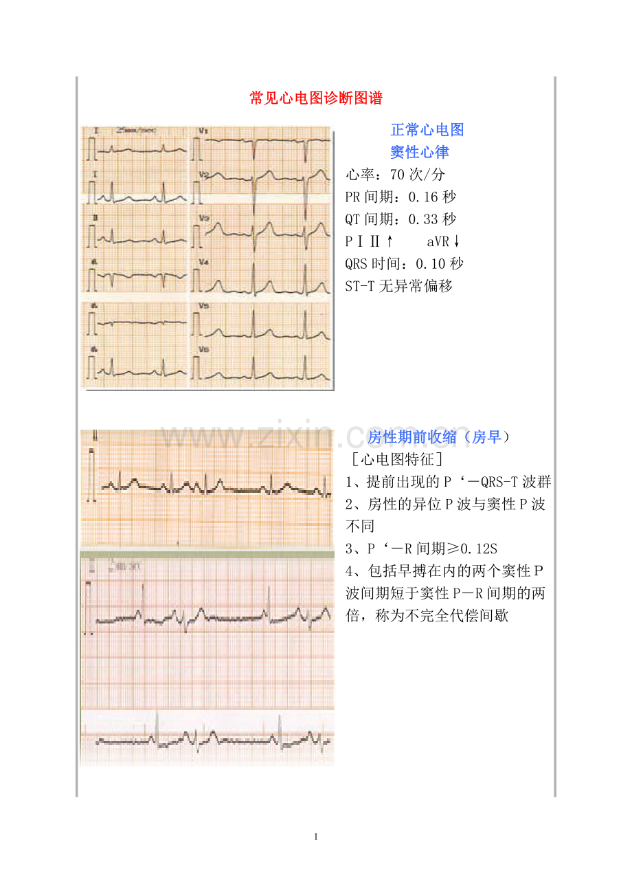 常见心电图诊断图谱.doc_第1页