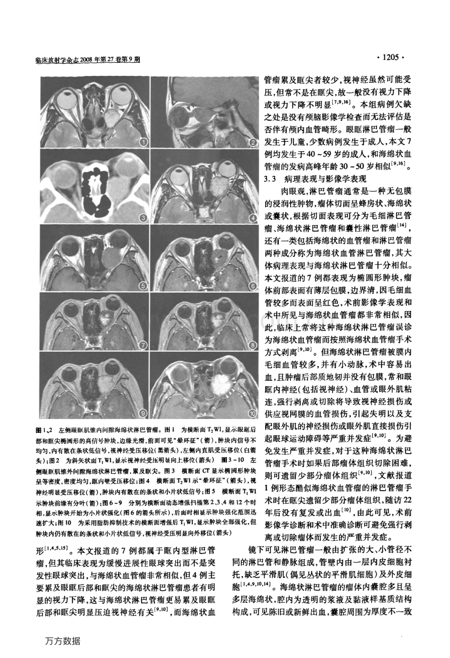 酷似海绵状血管瘤的眼眶海绵状淋巴管瘤的影像学表现.pdf_第3页