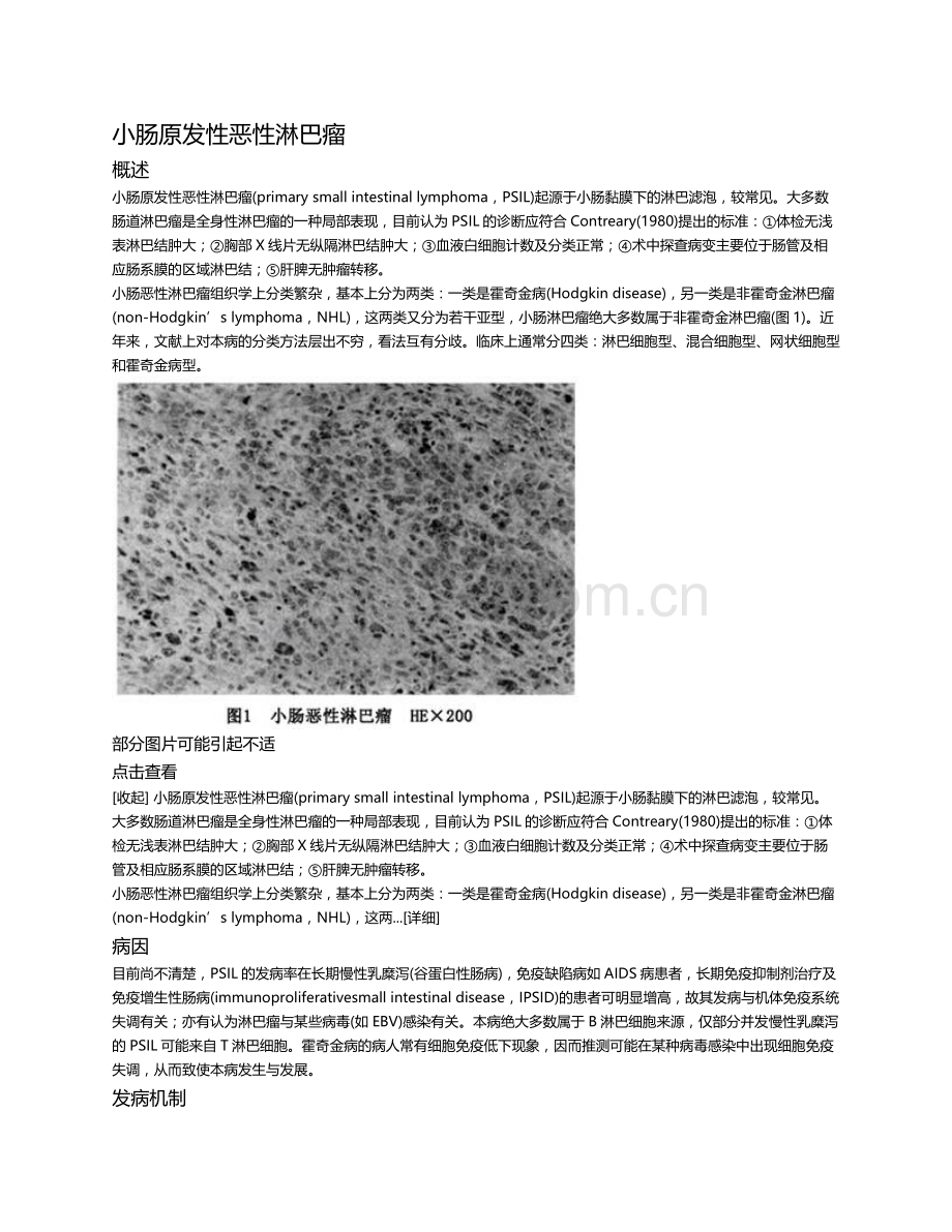 小肠原发性恶性淋巴瘤.doc_第1页