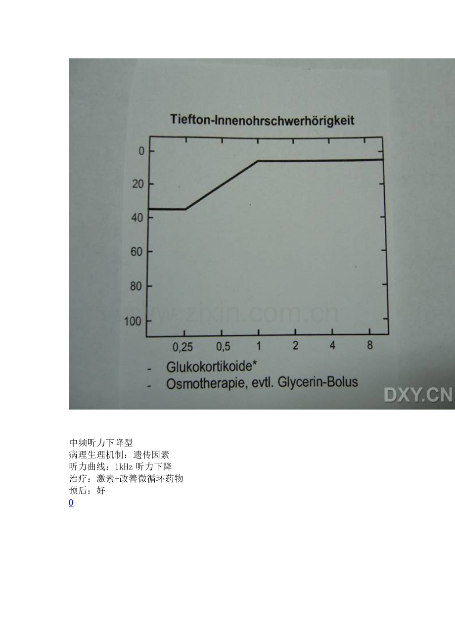 突发性耳聋的分型与治疗.doc_第2页