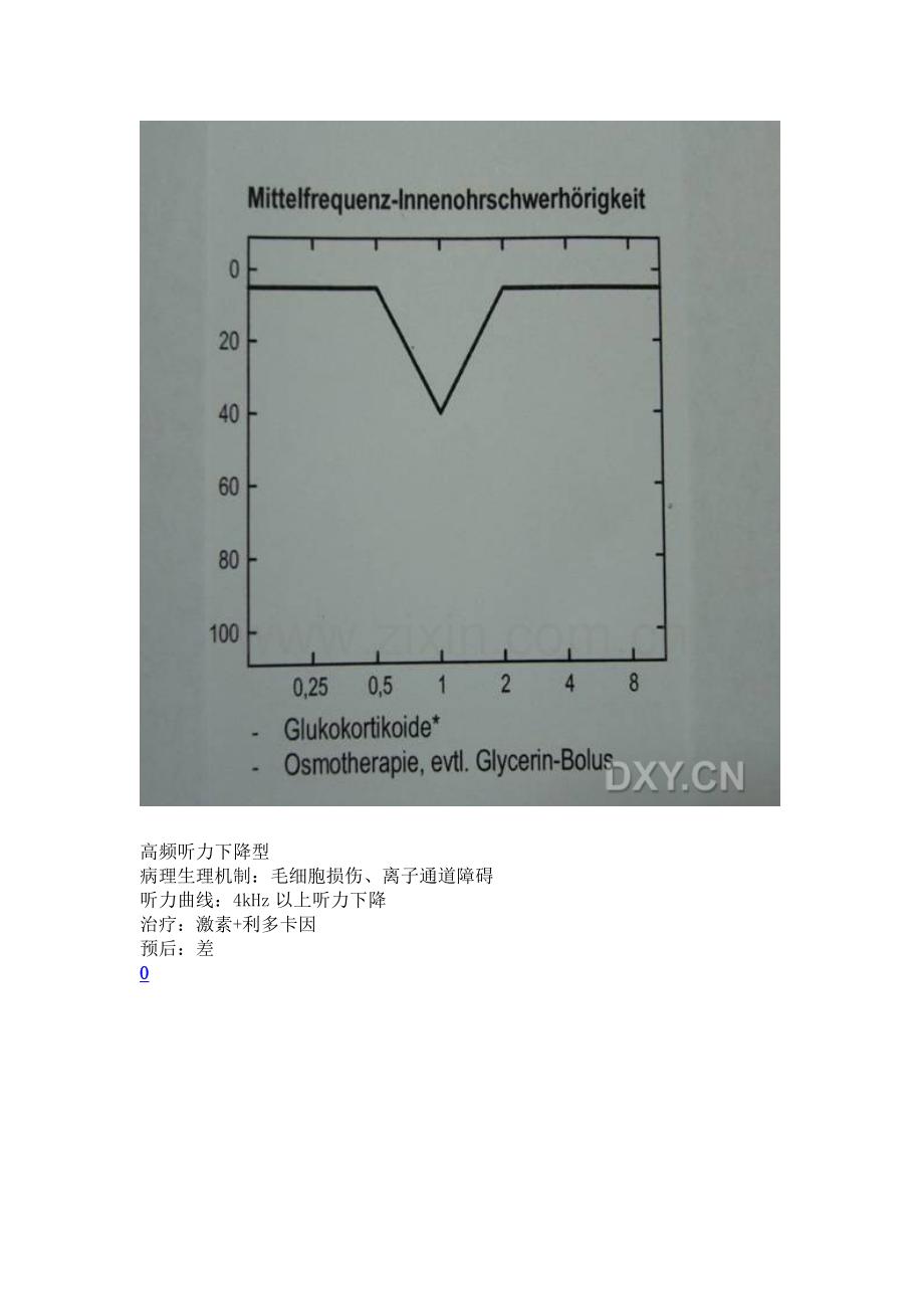 突发性耳聋的分型与治疗.doc_第3页