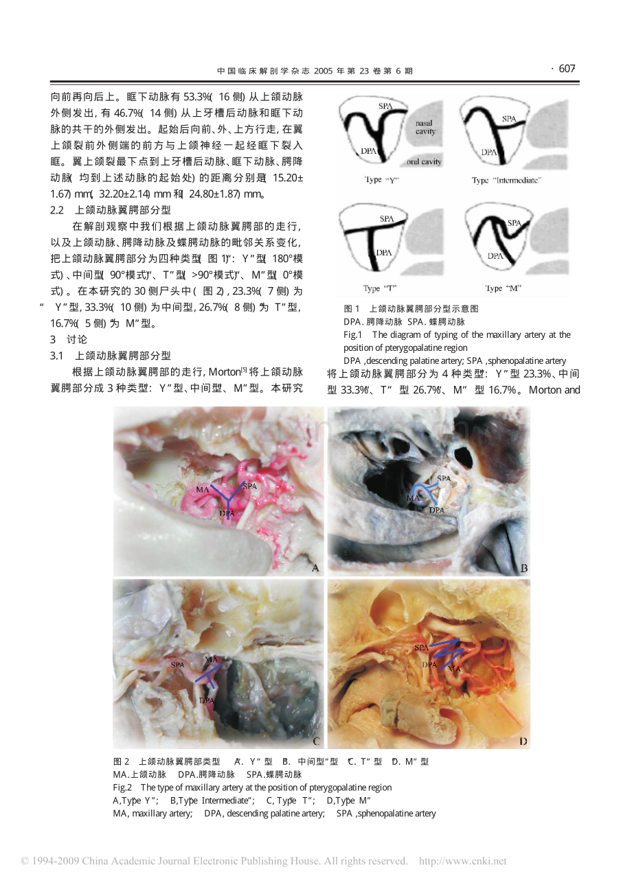 上颌动脉翼腭部的应用解剖.pdf_第2页