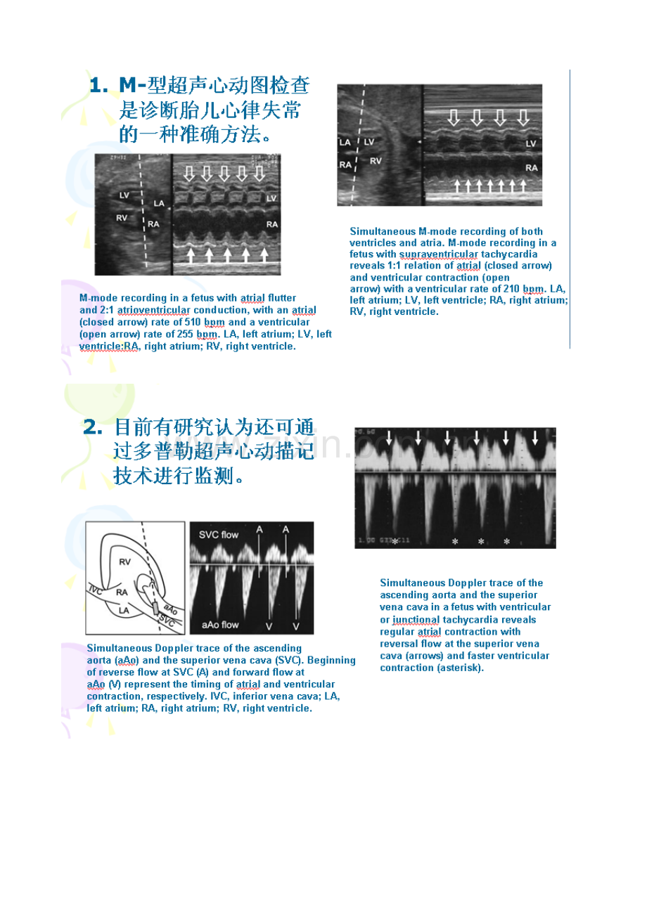 胎儿心律失常.doc_第2页