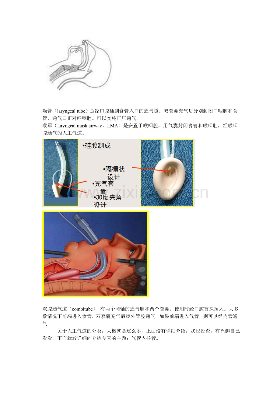 很粗略的介绍气管切开插管的相关问题.doc_第2页