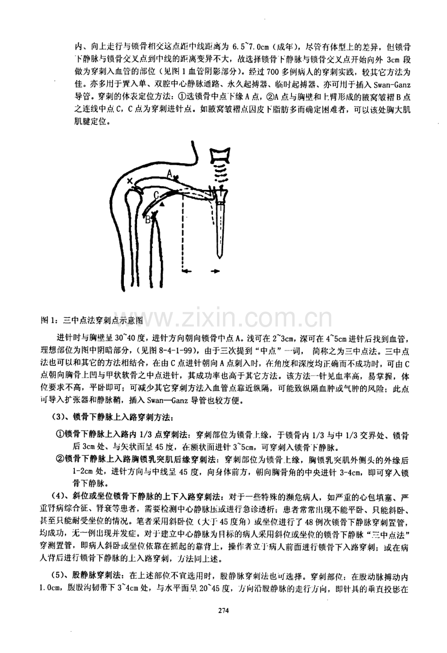 全身8部位16点静脉通路的建立方法和原则.pdf_第2页