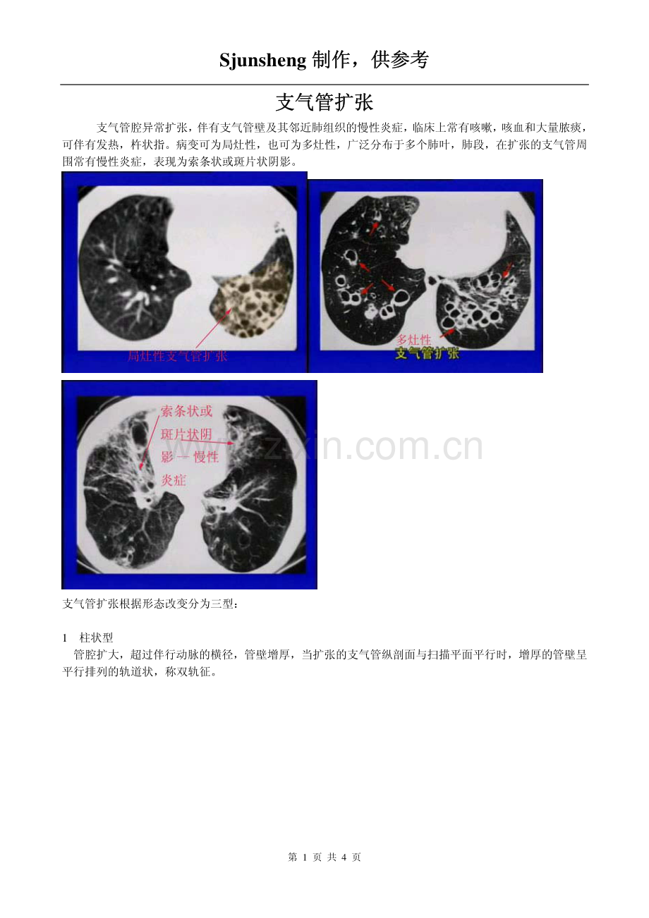 支气管扩张的CT图像.pdf_第1页