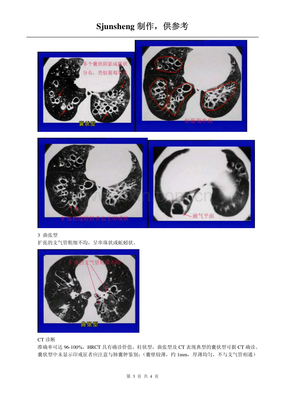 支气管扩张的CT图像.pdf_第3页