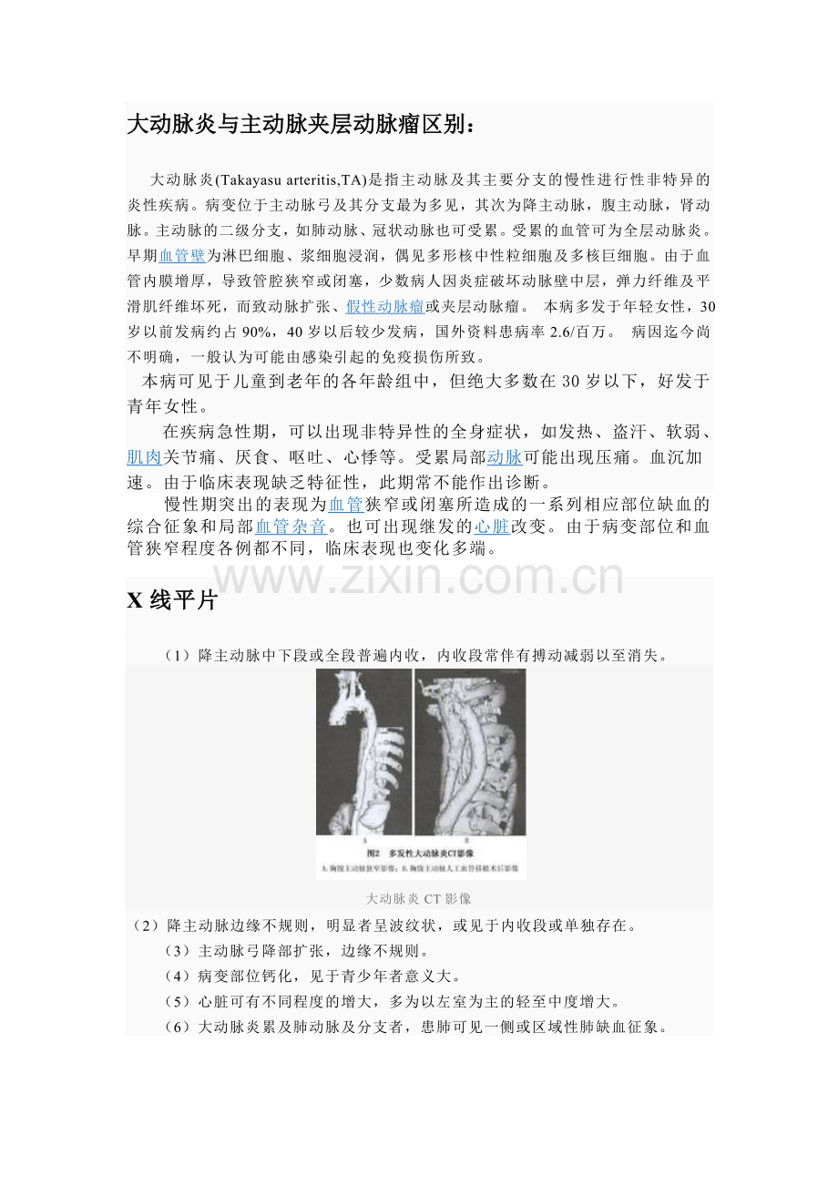 夹层动脉瘤鉴别诊断文档.doc_第2页