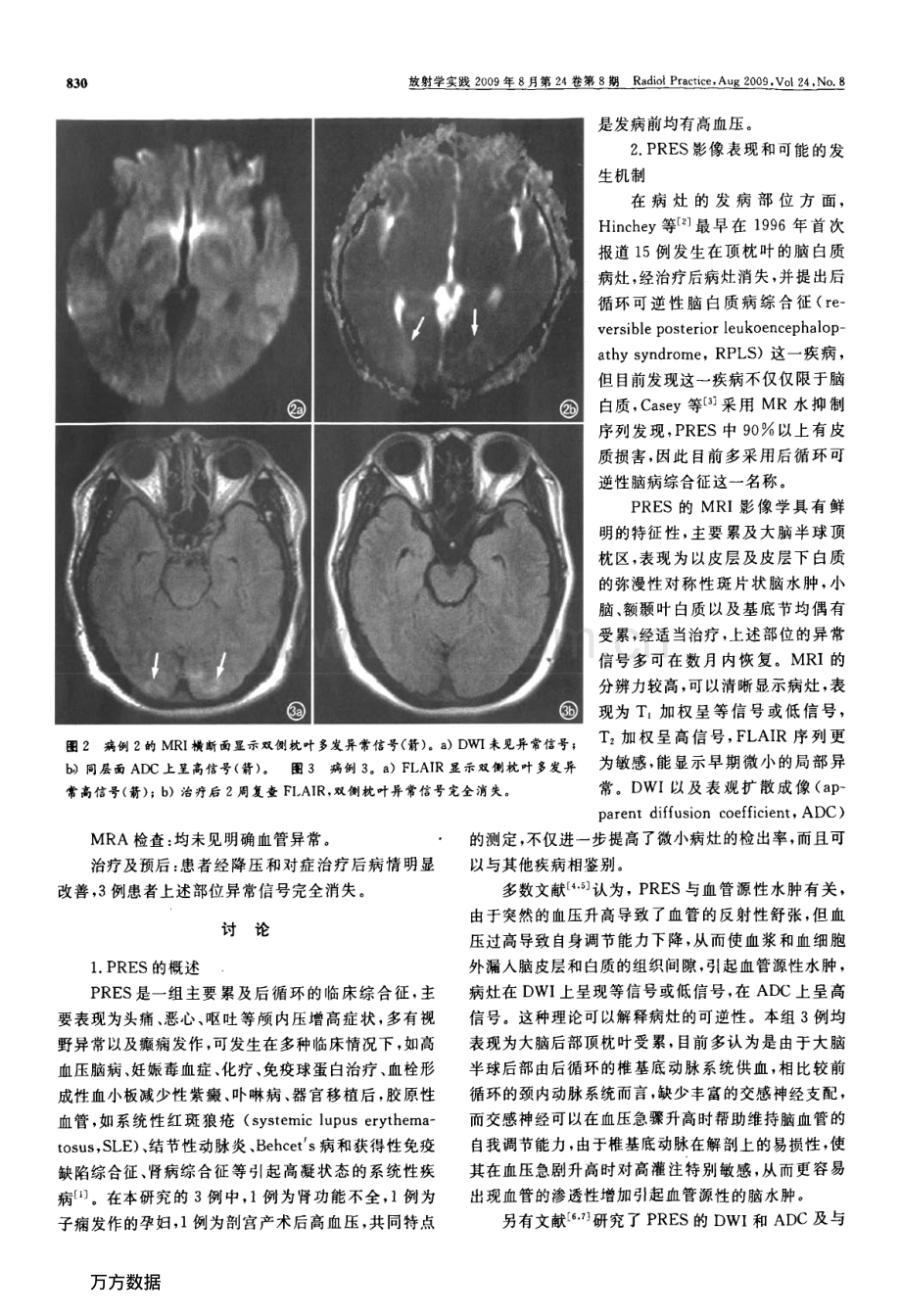 脑后部可逆性脑病综合征的MRI及DWI特点.pdf_第3页