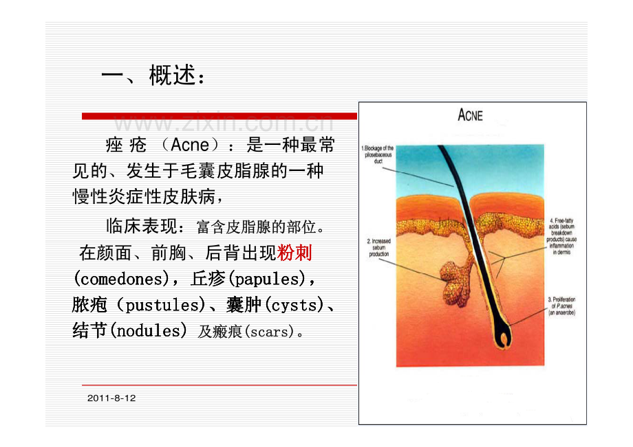 痤疮基础知识.pdf_第2页