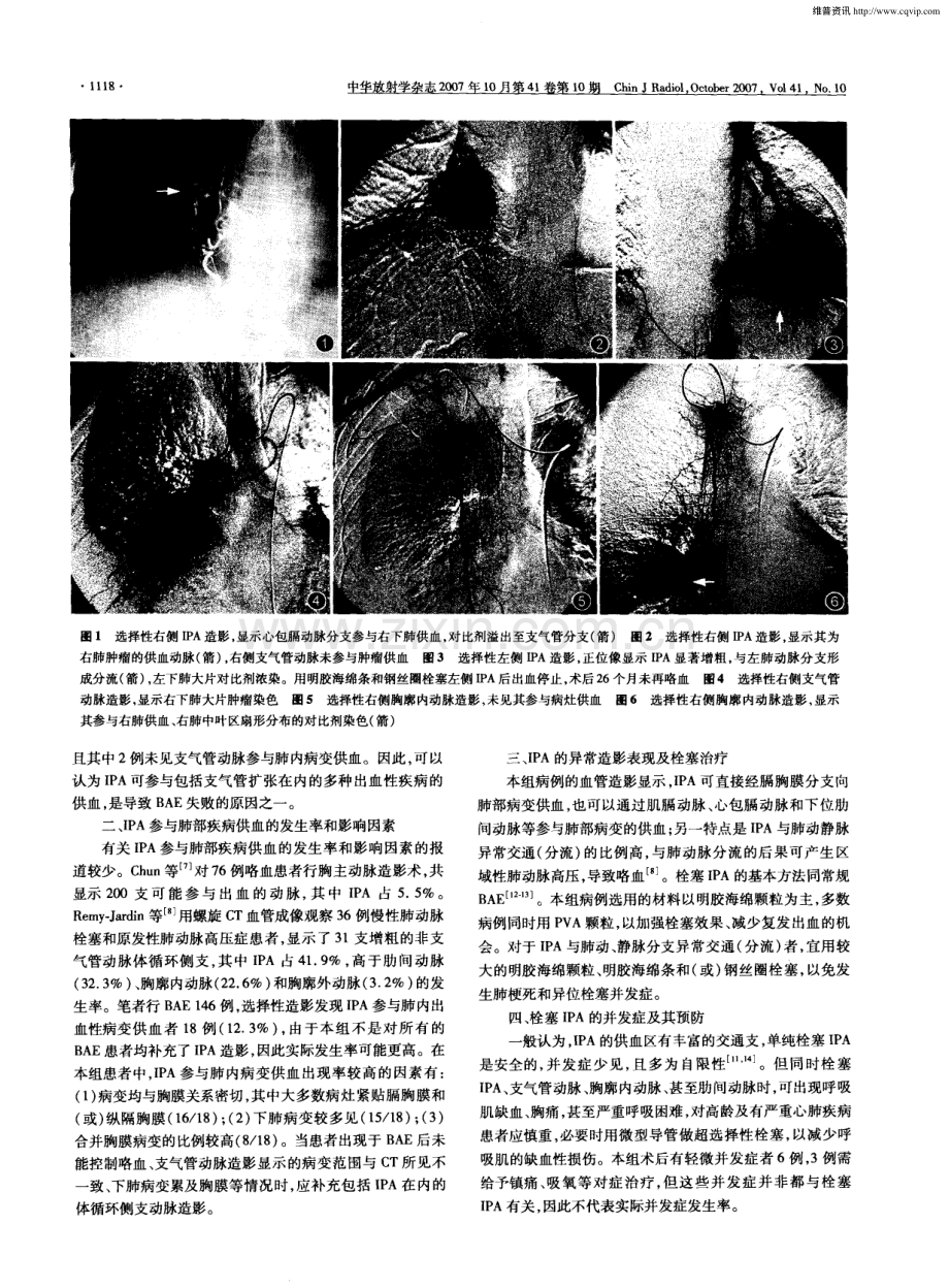 的肺部出血性疾病的诊断及介入治疗.pdf_第3页